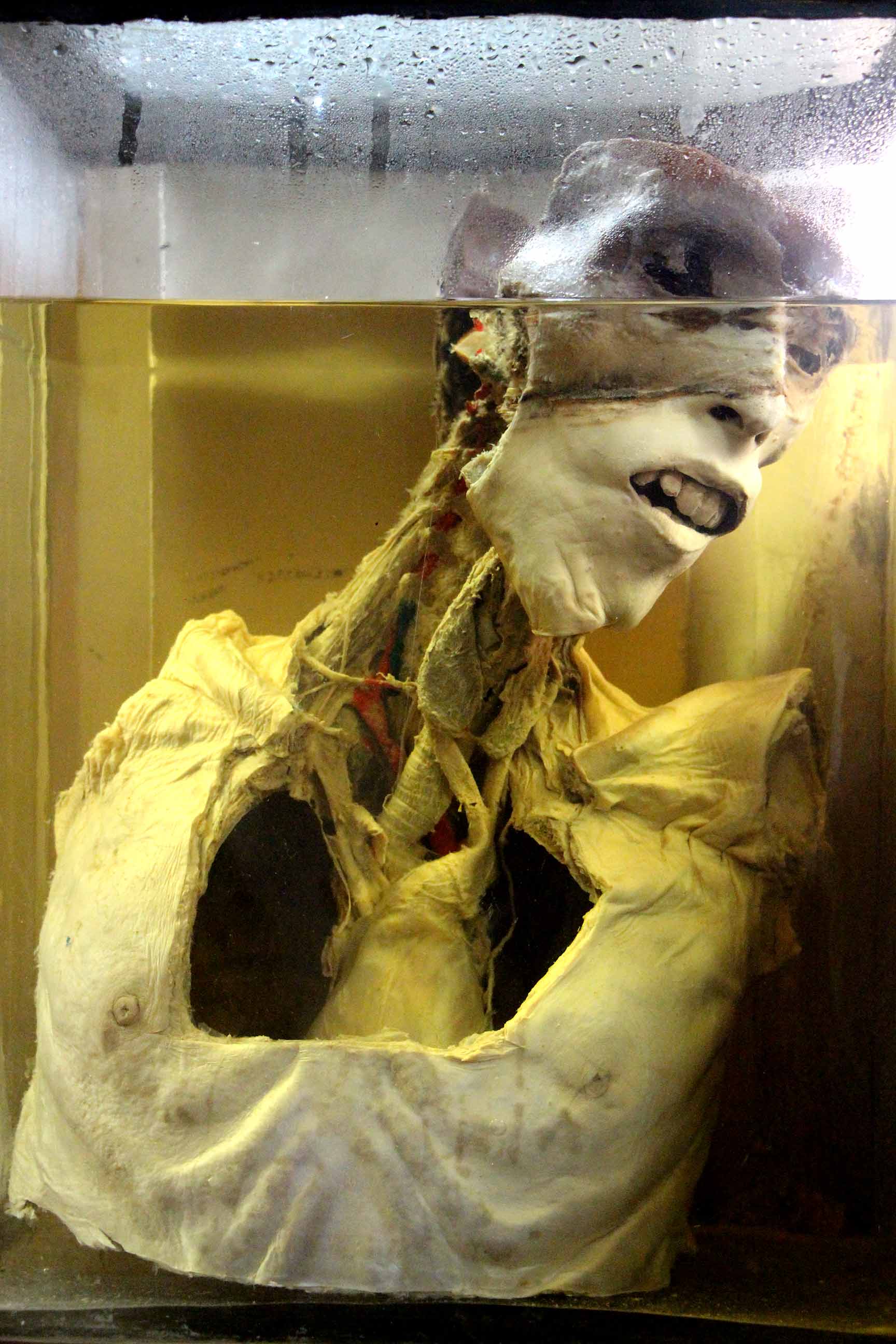 Anatomical display unit at Seth G.S Medical College, Anatomy Museum 