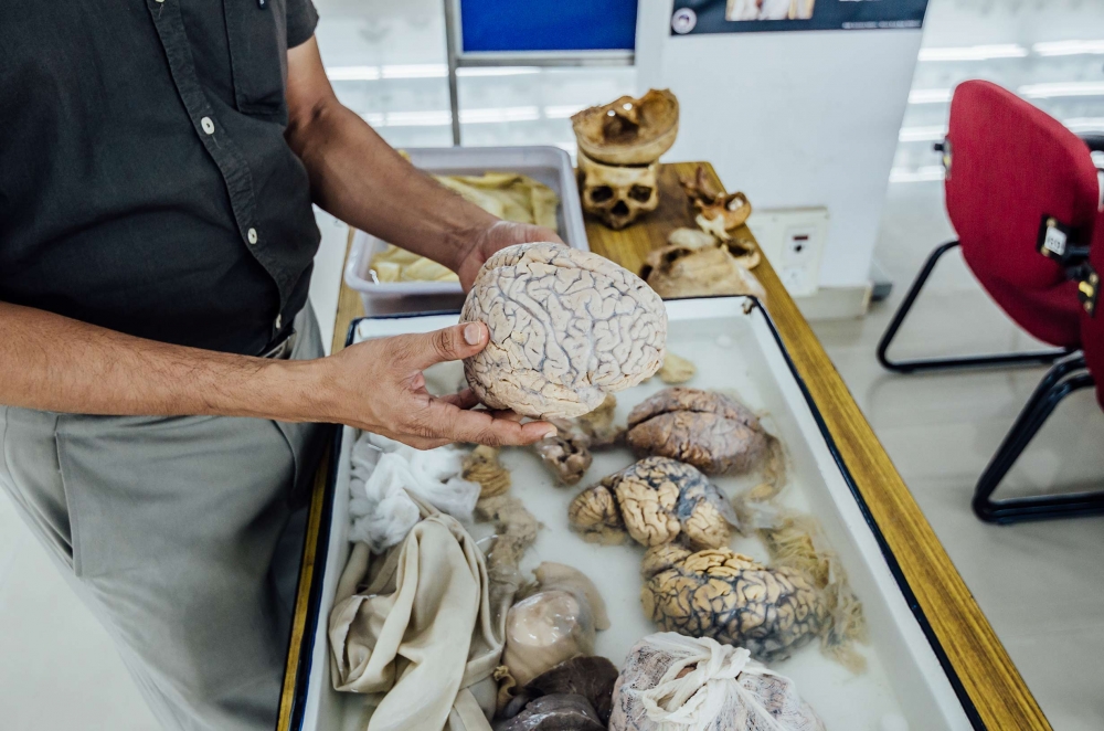 The museum exhibits brains affected by various head injuries, cerebrovascular diseases, brain infections, neurodegenerative disorders, brain tumors and brains of some animals species as well.